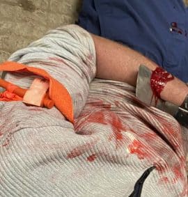 IRRTC IEC realistic training trauma care knife injury